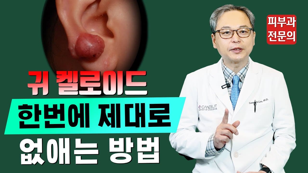 Ear Keloid Laser Treatment Removed At Once Without Surgery For Piercing Bumps