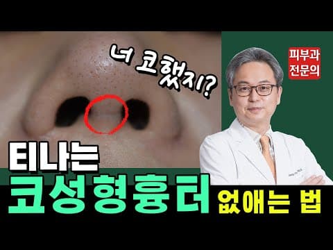 코성형흉터 비주흉터 수술 없이 티 안나게 없애는 법