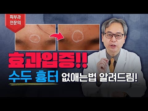 오래된 수두흉터도 확실하게 제거 치료할 수 있을까? ✅ 논문 입증