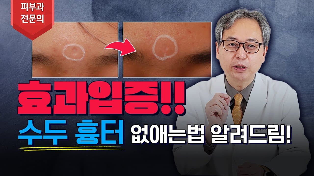 오래된 수두흉터도 확실하게 제거 치료할 수 있을까? ✅ 논문 입증
