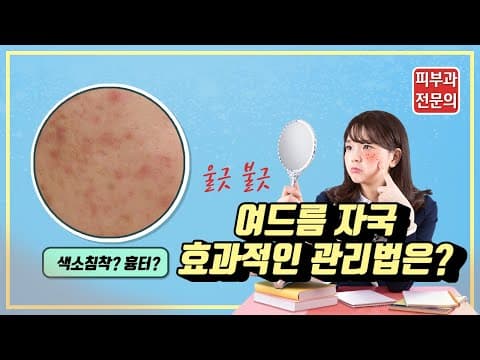 여드름자국을 지우는 방법! 피부과 전문의가 알려드립니다.(여드름흔적,색소침착,초기흉터)