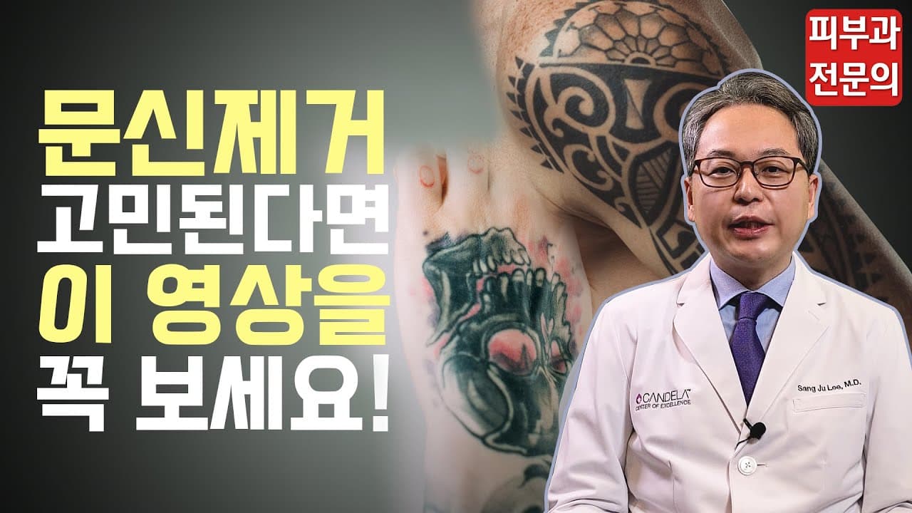 문신제거 고민된다면 이 영상을 꼭 보세요!(칼라문신&흑백문신)