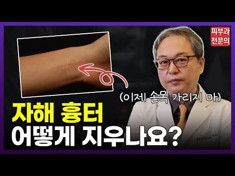 자해흉터 없애는 법, 연고로 치료 되나요? | 커버업 타투, 레이저
