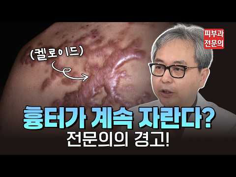 상처가 다 나았는데 왜 점점 부풀어 오를까? 돈과 시간 아끼는 초기 치료법