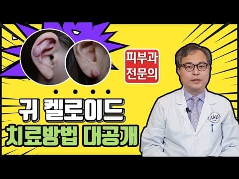 귀 켈로이드흉터(피어싱 살튀?)말끔한 제거법은!?