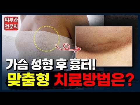 가슴성형 후 흉터 ❌수술하지 않고❌ 없애는 법 | 겨절 밑절 흉터