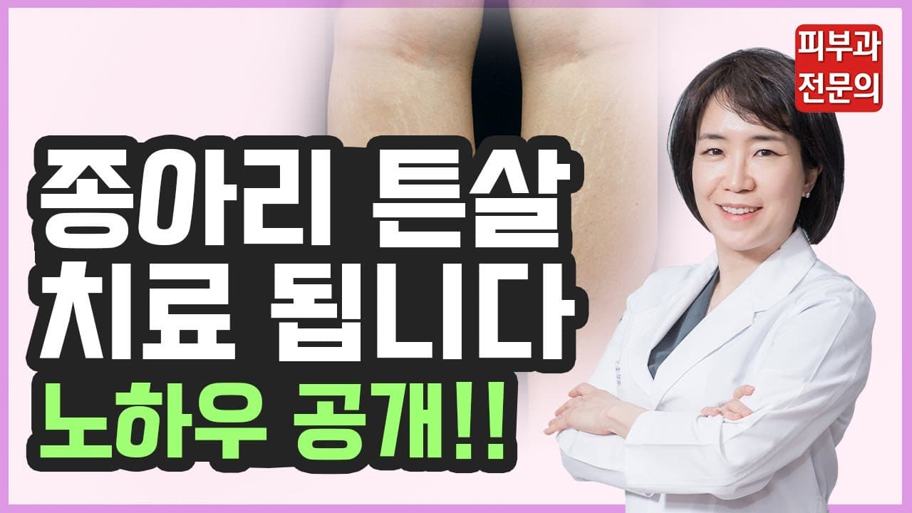 ふくらはぎの妊娠線レーザー治療を「こうすれば」効果が本当に良い!皮膚科専門医の良心告白|妊娠線を消す方法