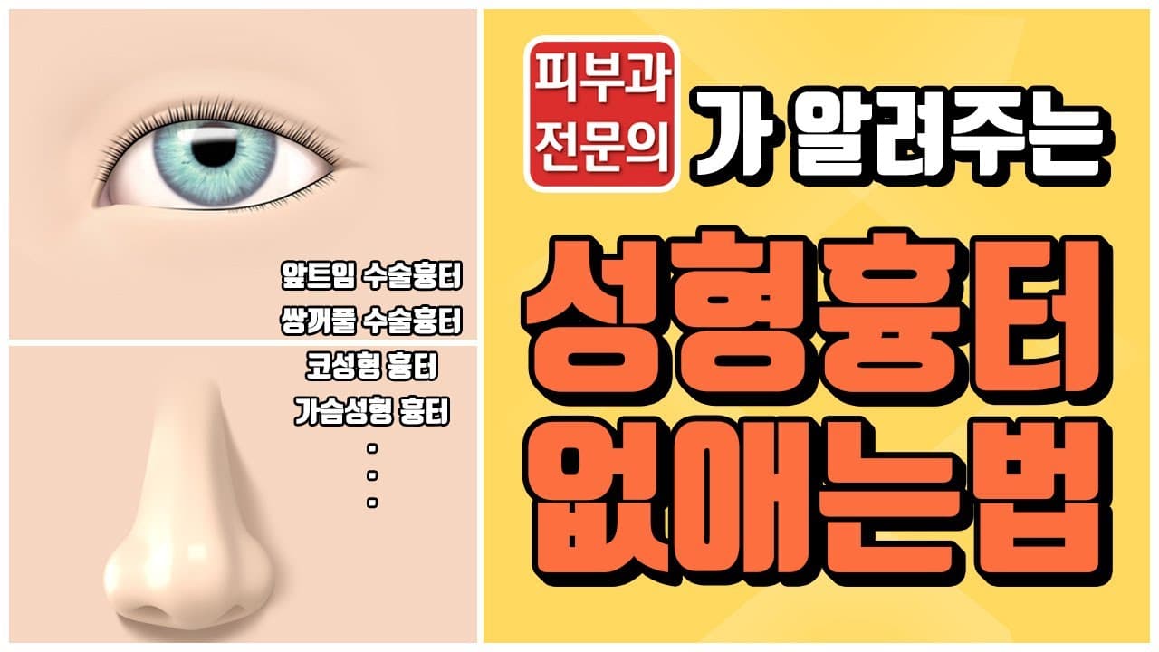 쌍꺼풀, 앞트임, 코성형 수술후 생긴 흉터 없애는법은?