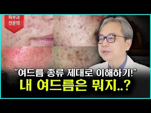 여드름 완전 정복! 종류부터 치료법까지 총정리