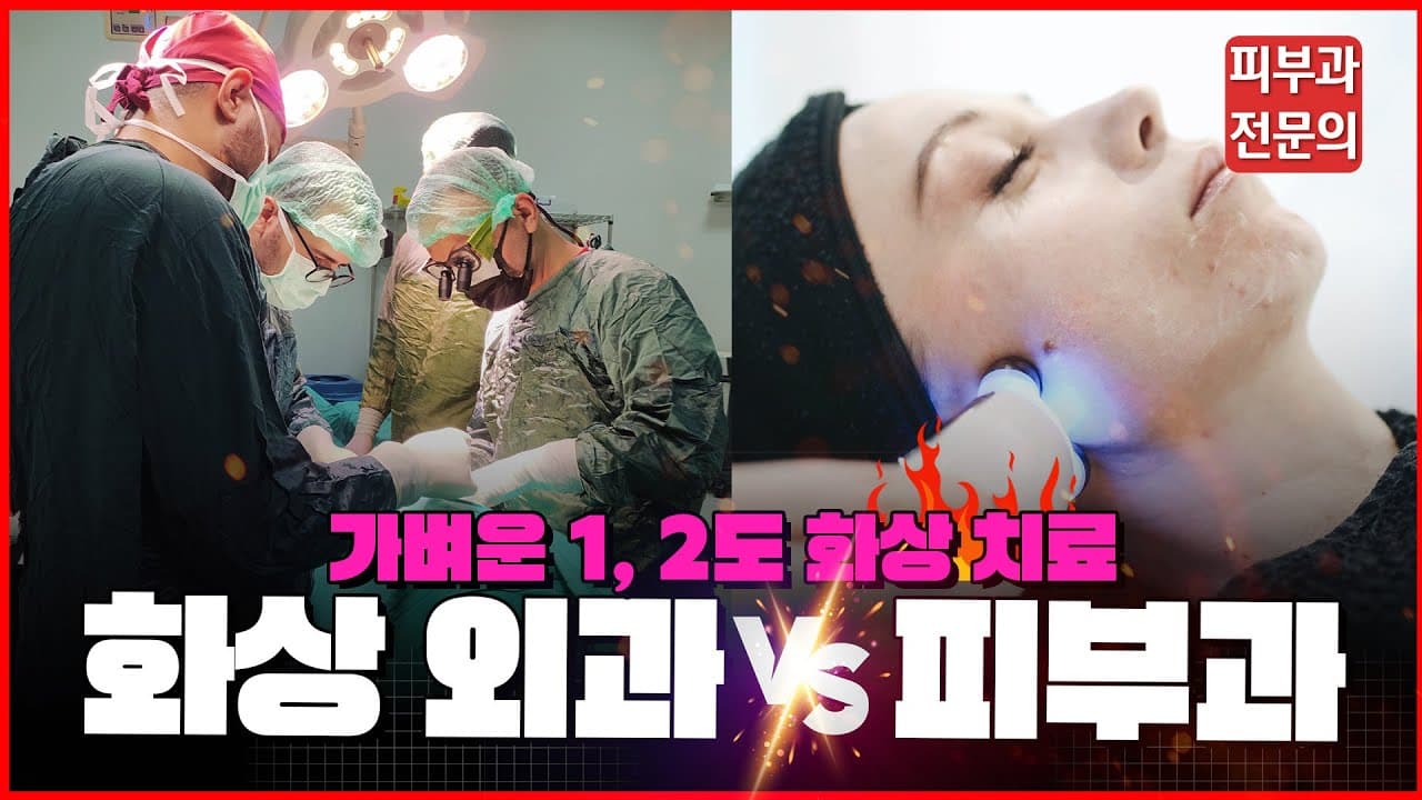 First And Second Degree Burns Burn Center Versus Dermatology