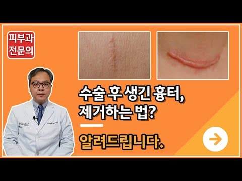 수술후 생긴 수술흉터, 제거 방법은?