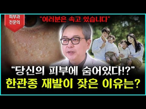 한관종은 대체 왜 재발이 될까요?