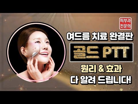 여드름 치료의 끝판왕! 골드 PTT 정확하게 알고 치료 하세요!