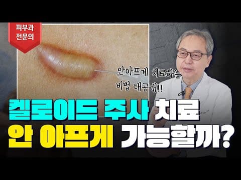 켈로이드 주사 통증을 크게 줄이는 비결 공개