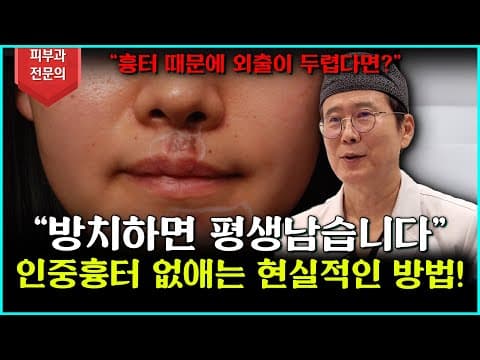 인중 흉터 없애는 법? 이 방법으로 확실하게 해결하세요!