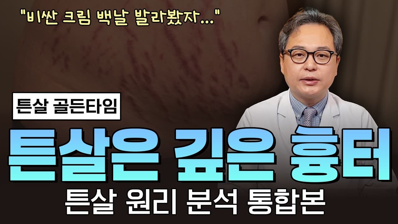 튼살은 흉터에 가까운 깊은 상처, 크림만으로는 부족한 이유를 말씀드립니다