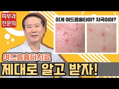여드름 흉터 치료, 꼭 알아야 할 것들