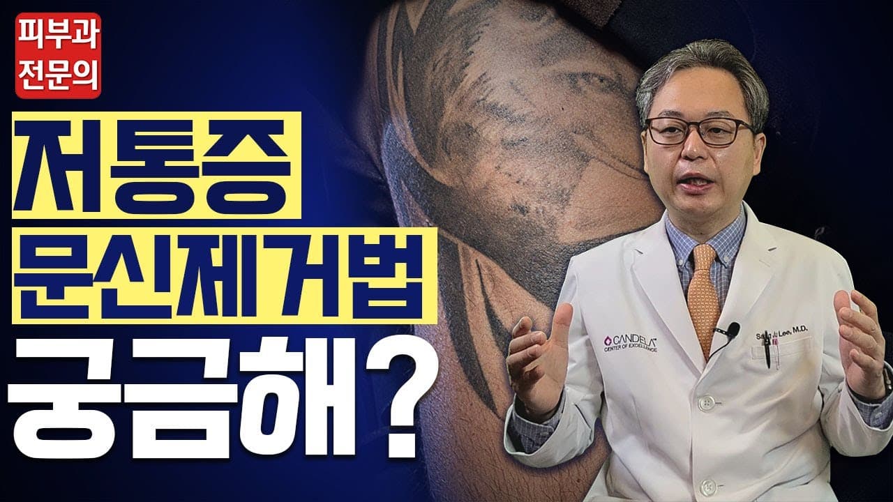 Low-Pain Tattoo Removal: How to Reduce Discomfort During the Procedure
