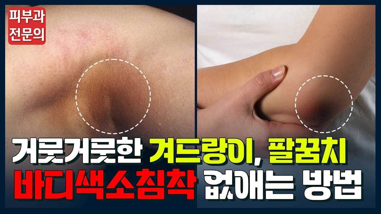 Dark Underarm And Elbow Pigmentation Everything You Need To Know