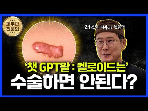 켈로이드 치료, 수술보다 중요한것은?