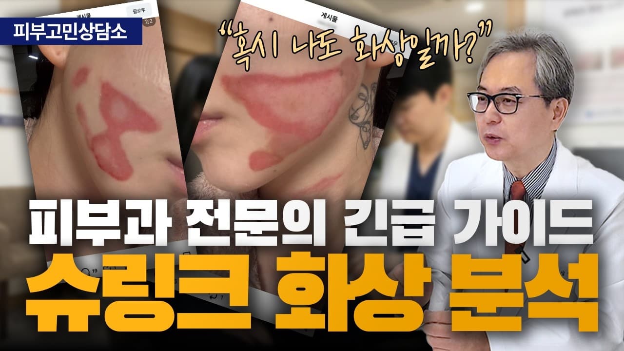리프팅 화상, 원리를 알면 막연한 공포에서 벗어날 수 있습니다 | 신촌 연세스타피부과
