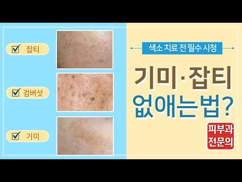 기미, 잡티, 검버섯 제거 치료전 필수 체크- 피부과 전문의