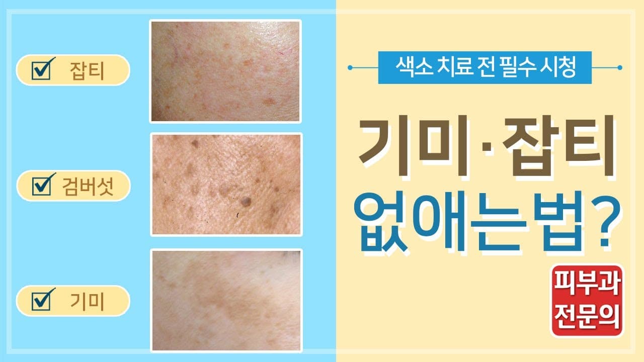 Essential Checklist Before Melasma Freckle And Age Spot Removal