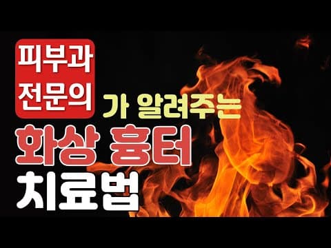 화상 흉터2편-화상흉터의 치료방법과 관리방법!