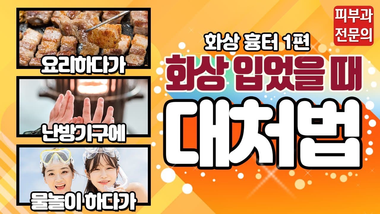 화상 흉터1편-화상 초기 대처! 이렇게 하세요!