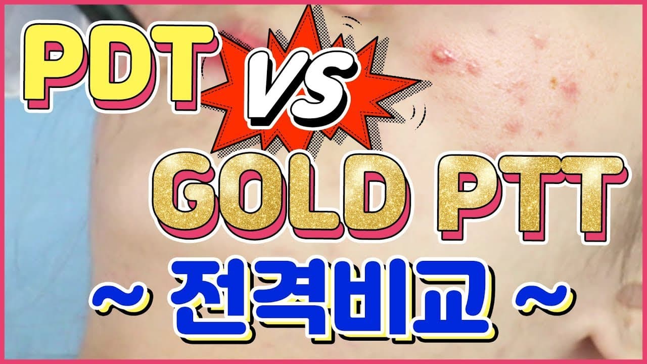 여드름 치료 골드PTT vs PDT 비교 분석