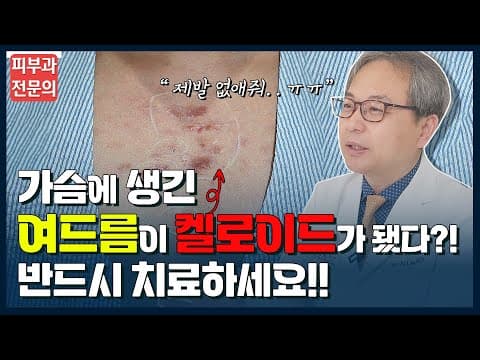 가슴에 생긴 여드름이 켈로이드로 변했다고요!? 켈로이드 완벽하게 없애는법!