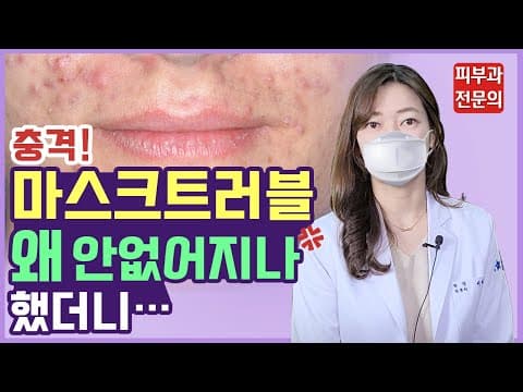 마스크 트러블 이렇게 치료하면 더 심해집니다. | 마스크 여드름 진정&없애는 법