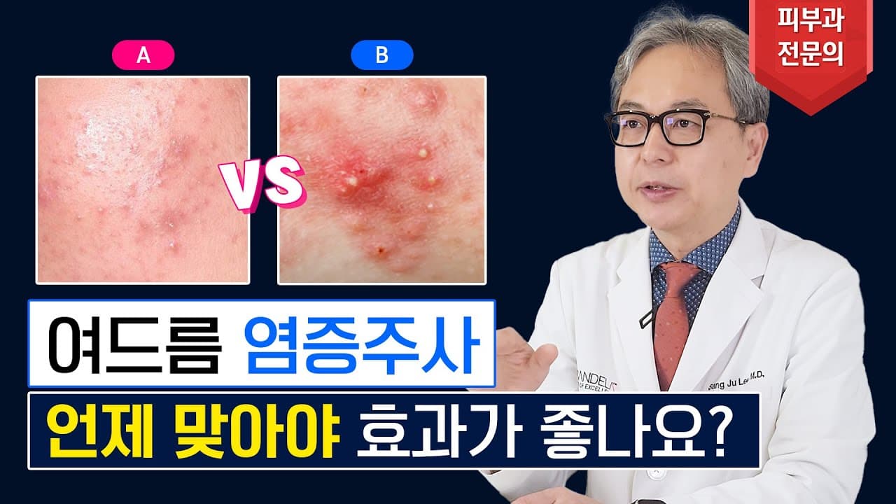 Acne Cortisone Injection Timing: When To Get It, Must-Watch Before Treatment