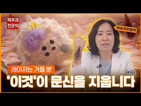 "문신제거는 레이저가 하는 게 아닙니다" 피부과 전문의가 밝히는 진짜 원리