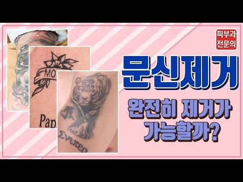 문신제거 전 필수 시청 (피부과 전문의)