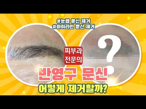 반영구 문신 제거의 모든 것