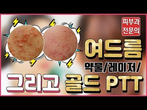 여드름 없애는 새로운 치료방법? 골드 PTT?