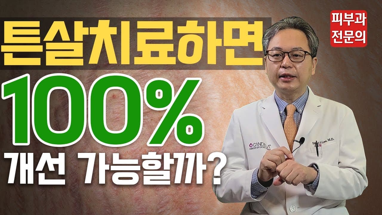 Stretch Mark Laser: Can Treatment Remove Them 100%?