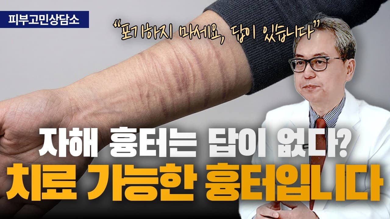 주저흔, 답이 없는 게 아니라 답을 줄 곳을 만나기 어려웠을 뿐입니다