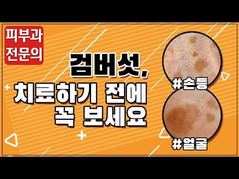 검버섯, 치료하기 전에 꼭 보세요(feat.피부암)