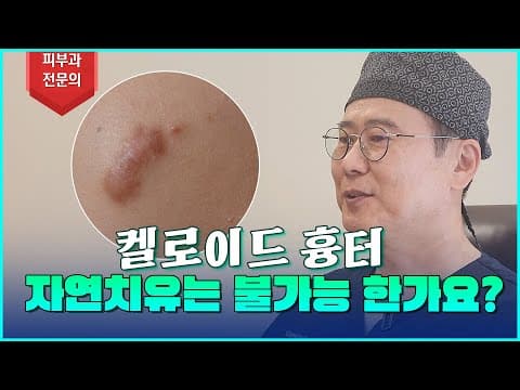 켈로이드에 관한 오해와 진실!! 피부과전문의가 정확히 알려드리겠습니다!