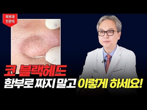 피부과 의사가 직접 알려주는 블랙헤드 없애는 방법!!