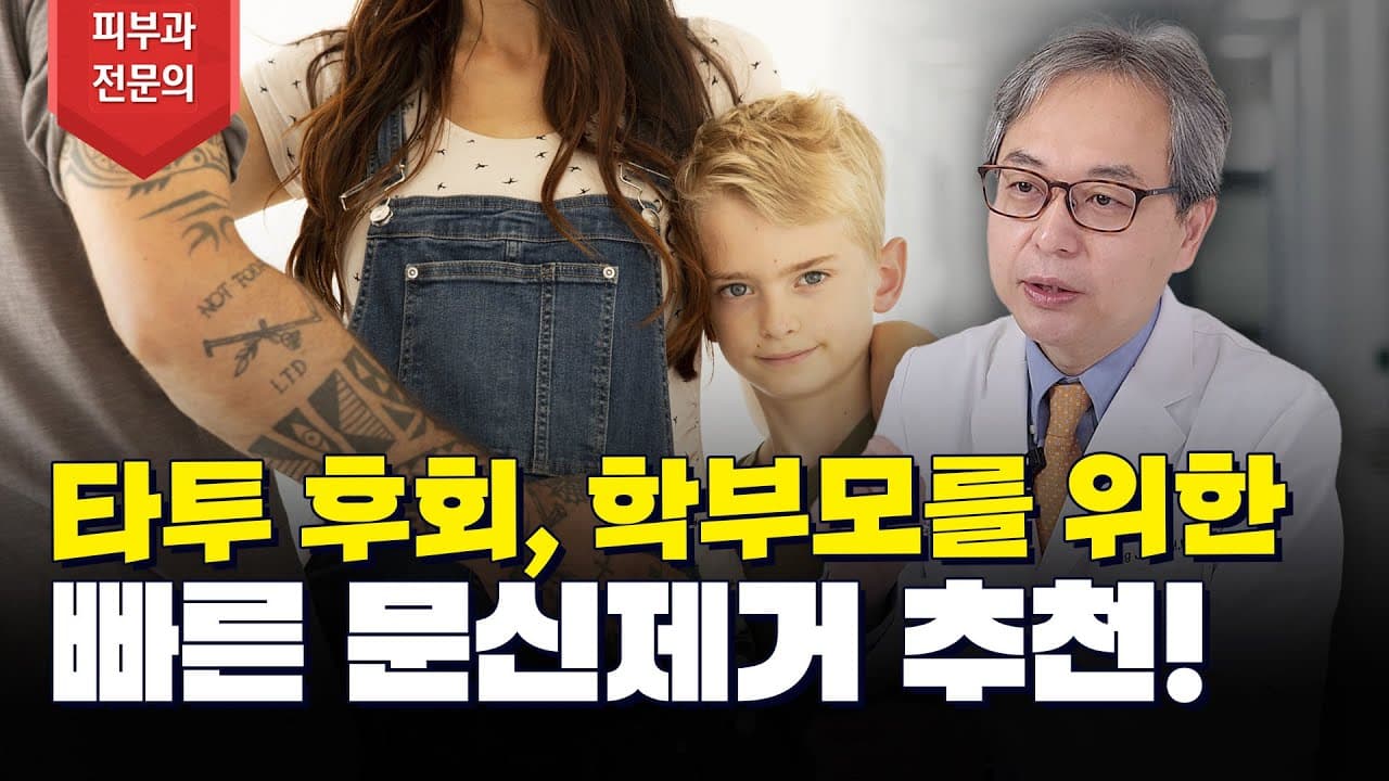 Tattoo Regret For Parents: A Fast Removal Method For Moms And Dads
