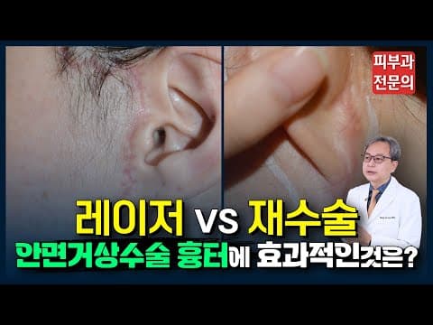 안면거상 수술 흉터 레이저 VS 재수술 뭐가 더 효과적일까? 🩹 수술흉터 없애는법, 제거, 치료