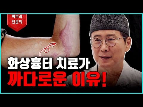 화상흉터 치료는 왜 어려울까!?