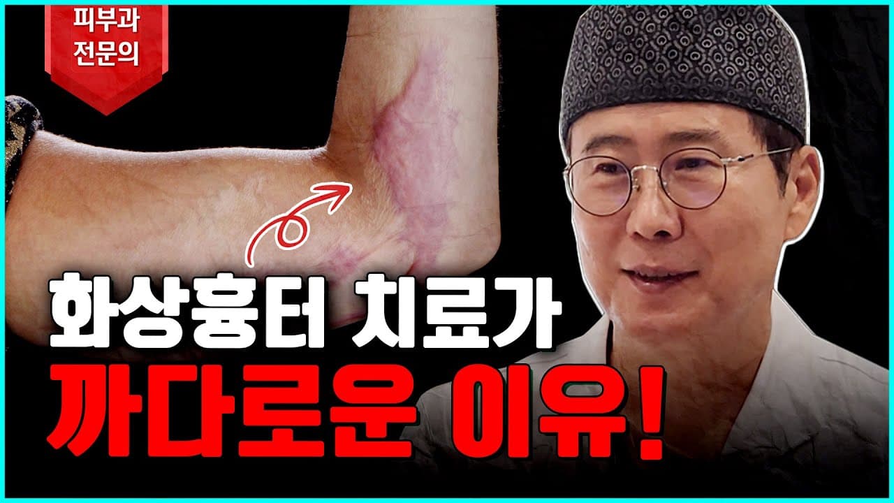 화상흉터 치료는 왜 어려울까!?