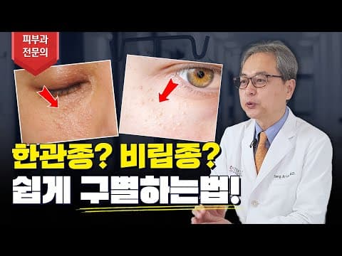 한관종 비립종 차이부터 아그네스 치료 실제 효과까지‼ 한관종 관련 궁금증 전부 해결해드립니다