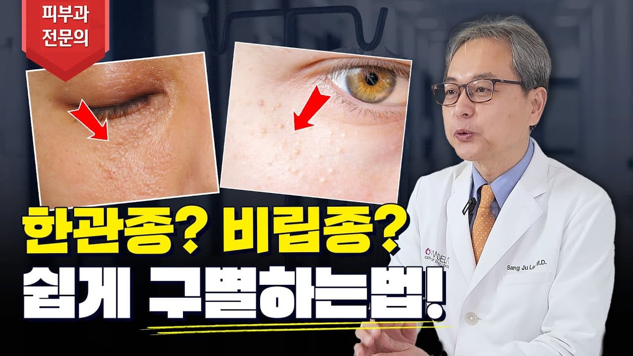 한관종 비립종 차이부터 아그네스 치료 실제 효과까지‼ 한관종 관련 궁금증 전부 해결해드립니다