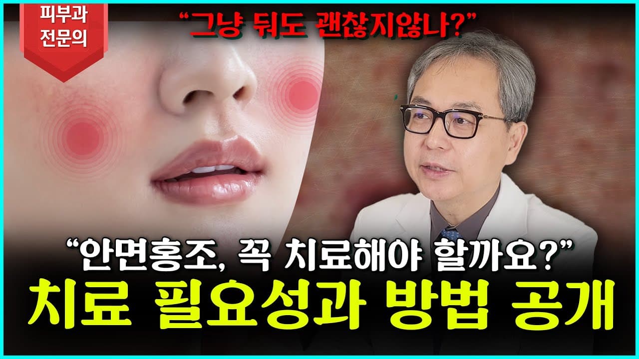 面部潮红,为什么一定要治疗?