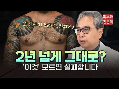 이레즈미 문신 제거 2년째 제자리 걸음인 분들, 피부과 전문의가 팩트만 말씀드립니다 #문신제거병원 #문신제거후기 #타투제거